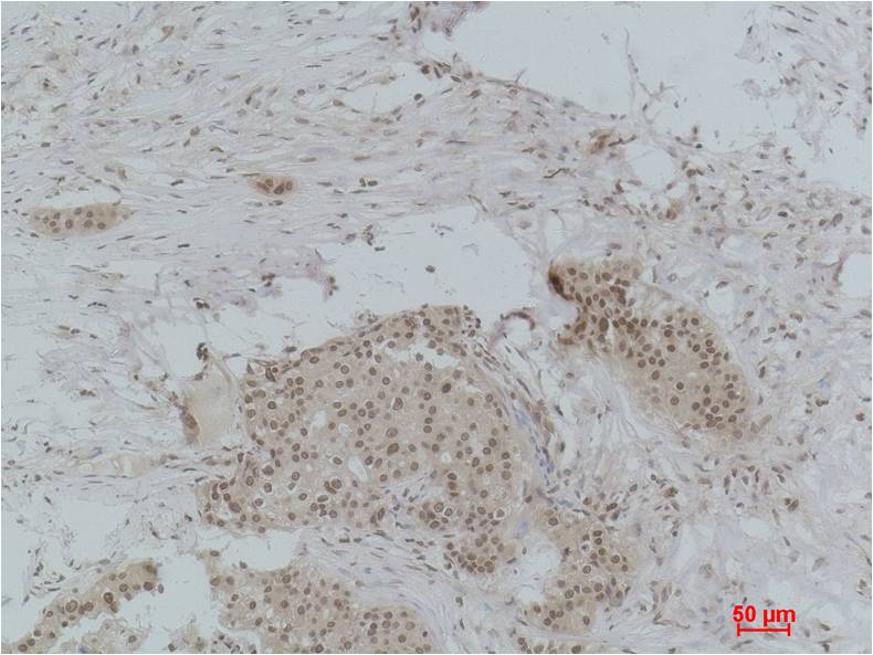 Histone H3 (Mono Methyl Lys9) Polyclonal Antibody