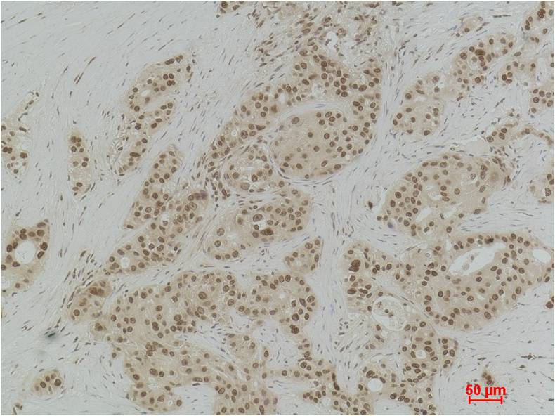 Histone H3 (Di Methyl Lys9) Polyclonal Antibody