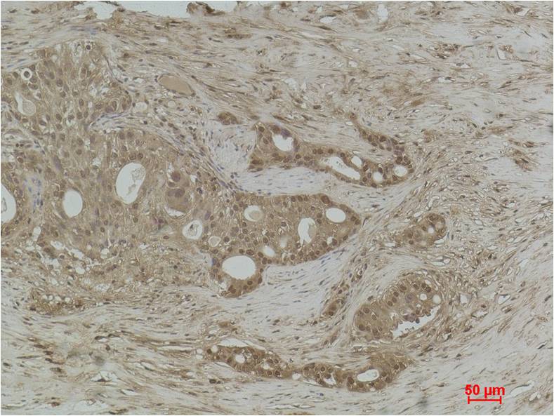 Histone H3 (Di Methyl Lys14) Polyclonal Antibody