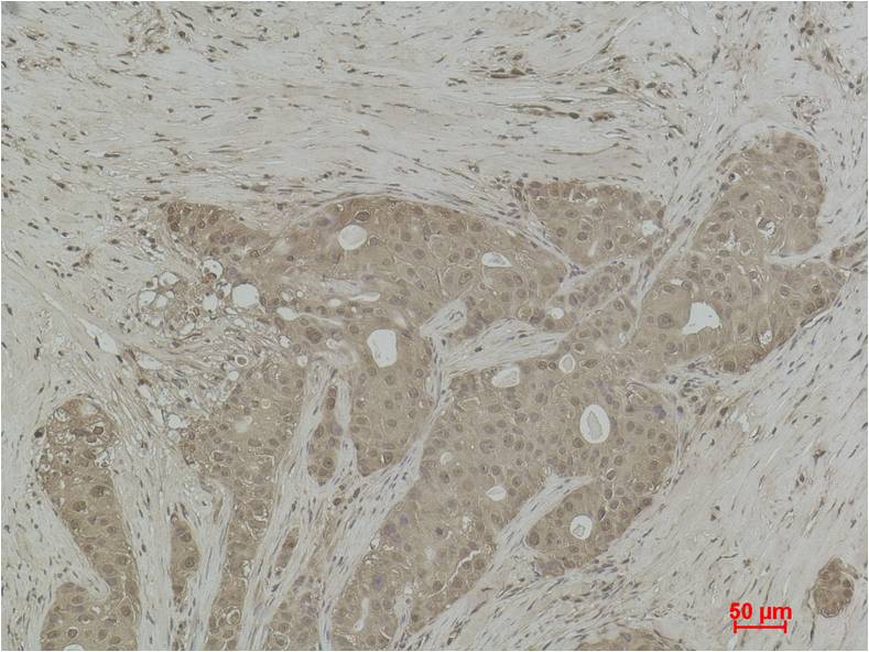 Histone H3 (Tri Methyl Lys14) Polyclonal Antibody