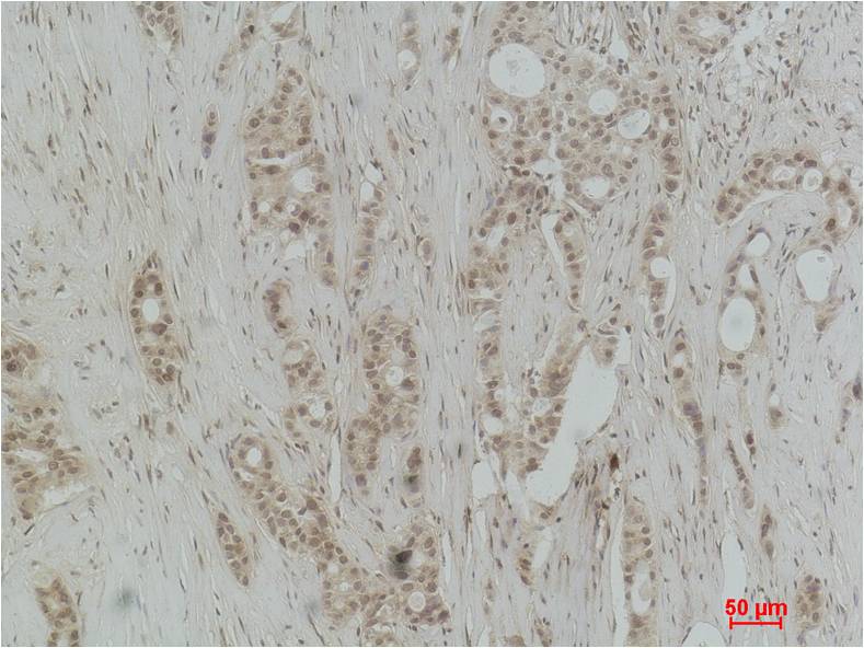 Histone H3 (Mono Methyl Arg17) Polyclonal Antibody