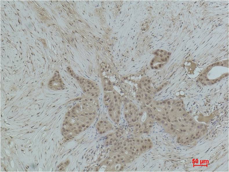 Histone H3 (Mono Methyl Lys18) Polyclonal Antibody