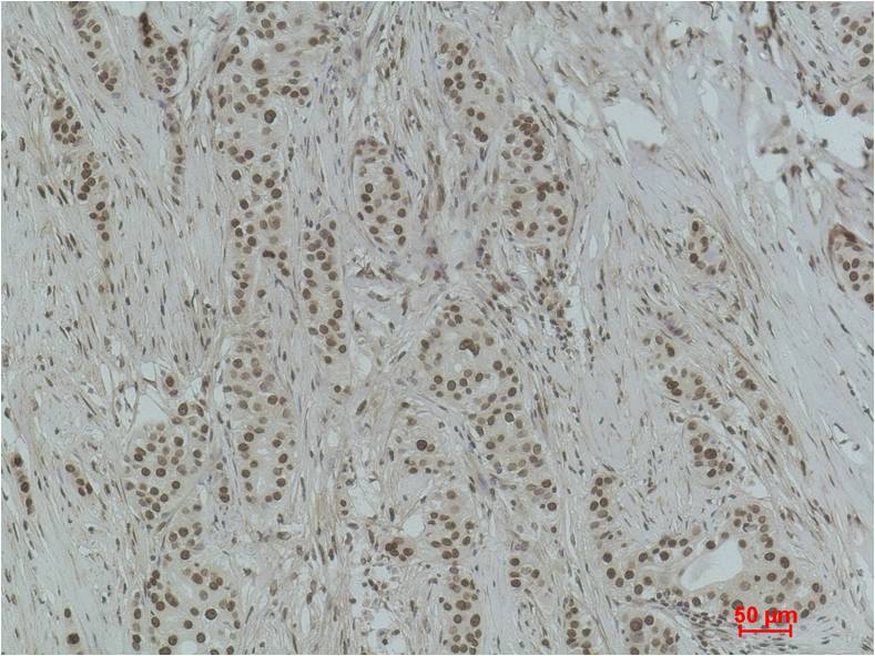 Histone H3 (Di Methyl Lys18) Polyclonal Antibody