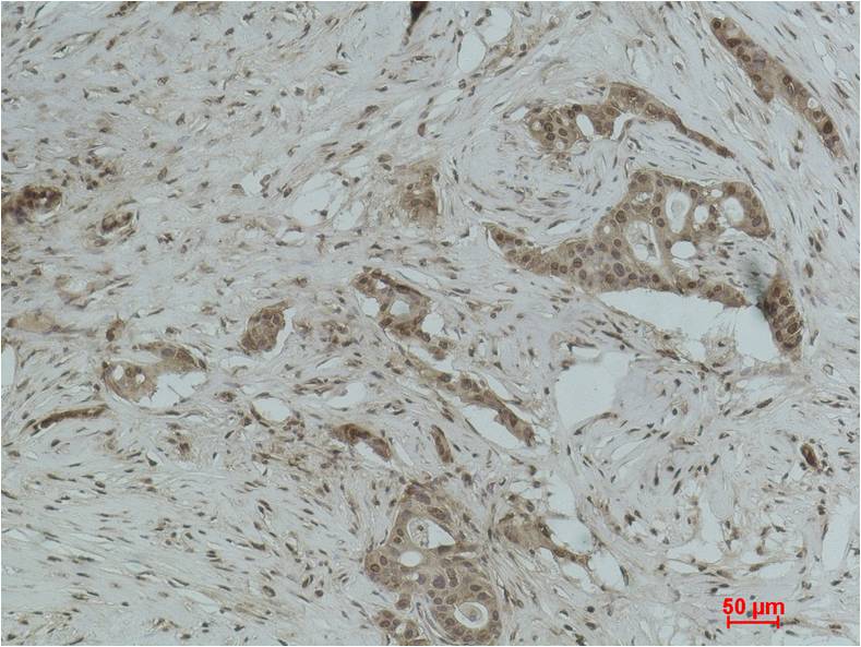Histone H3 (Tri Methyl Lys18) Polyclonal Antibody
