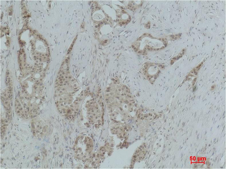 Histone H3 (Mono Methyl Arg26) Polyclonal Antibody