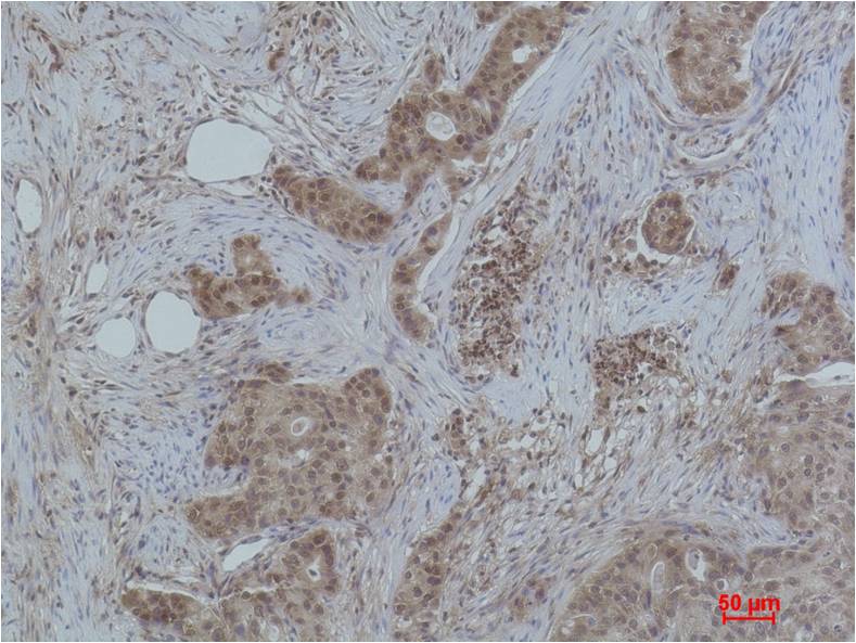 Histone H3 (Di Methyl Lys27) Polyclonal Antibody