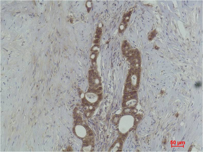 Histone H3 (Tri Methyl Lys27) Polyclonal Antibody