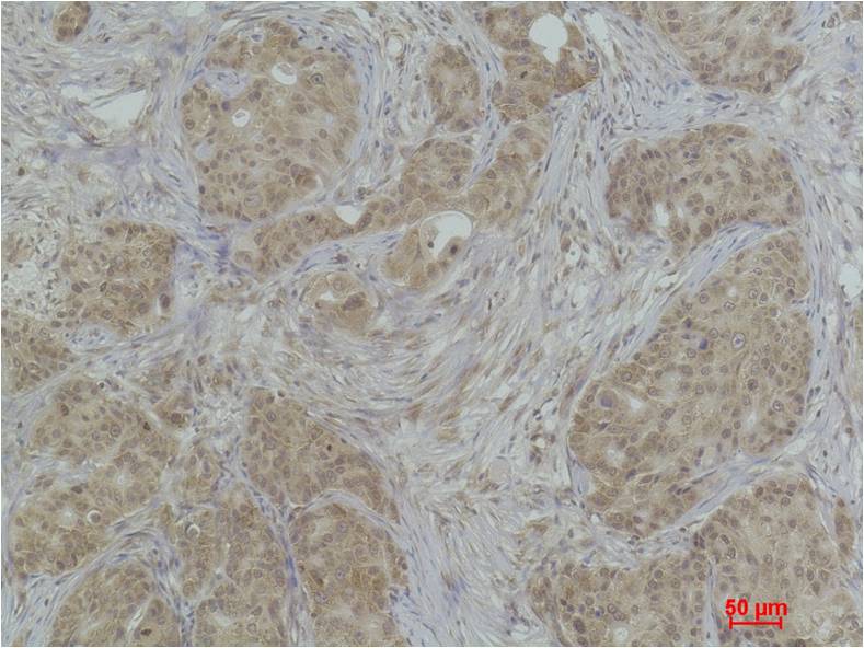 Histone H3 (Mono Methyl Lys36) Polyclonal Antibody