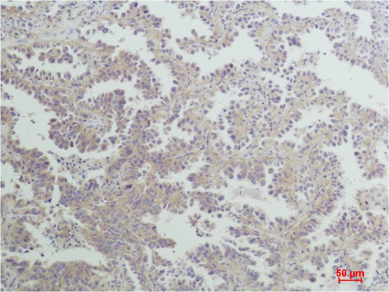 Histone H3 (Tri Methyl Lys36) Polyclonal Antibody
