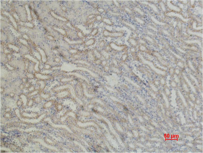 beta 1 Sodium Potassium ATPase Polyclonal Antibody
