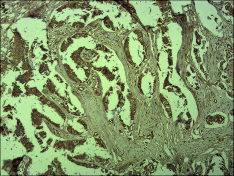 Beta-Catenin Polyclonal Antibody