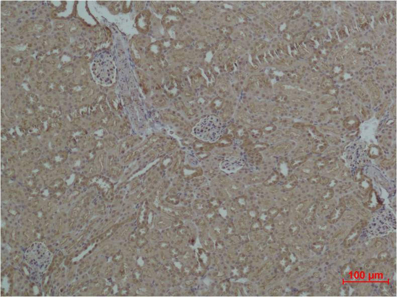 HSP27 Polyclonal Antibody (F157)