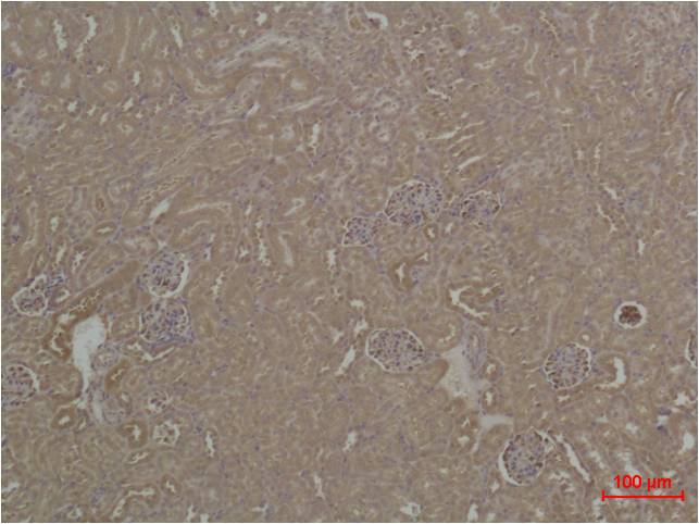 HSC70 Polyclonal Antibody (F153)