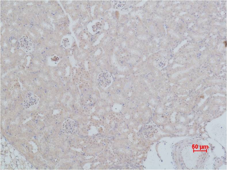 HSC70 Polyclonal Antibody (F154)