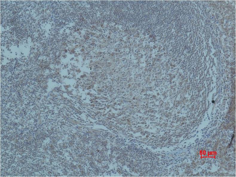 HIF-1 Beta ARNT Polyclonal Antibody (F144)
