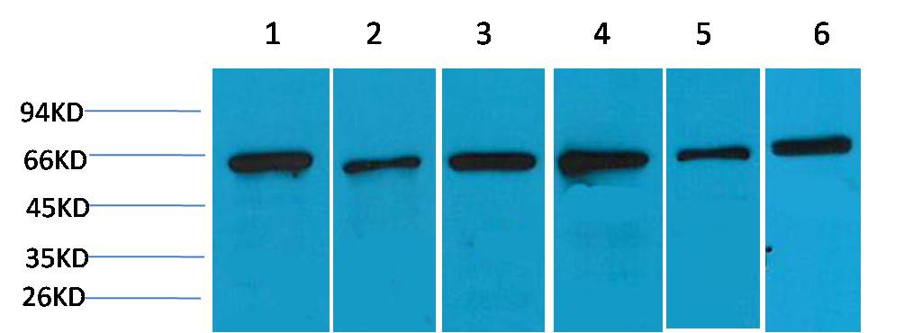 AMPK Alpha2 Polyclonal Antibody (F119)