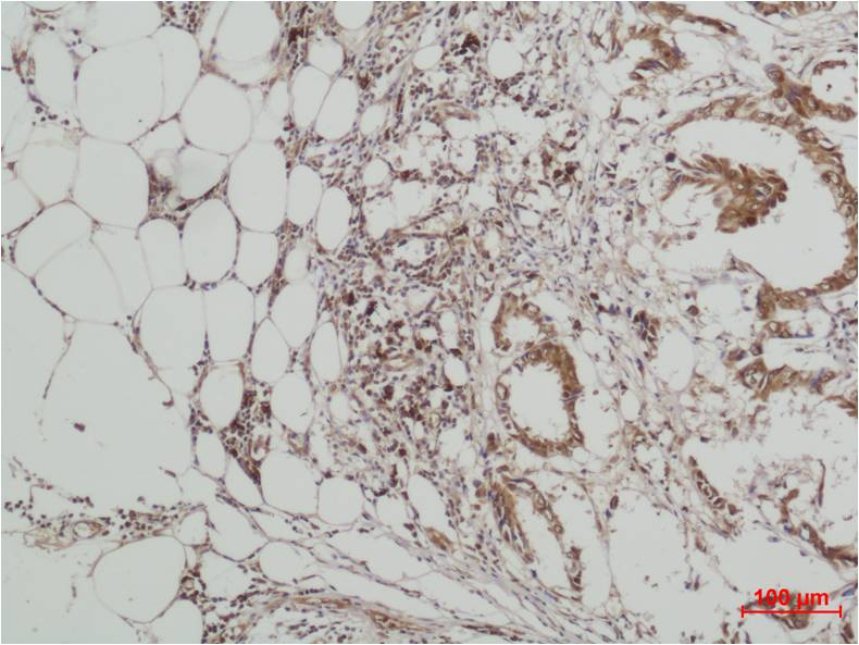 ERK5 Polyclonal Antibody (F139)