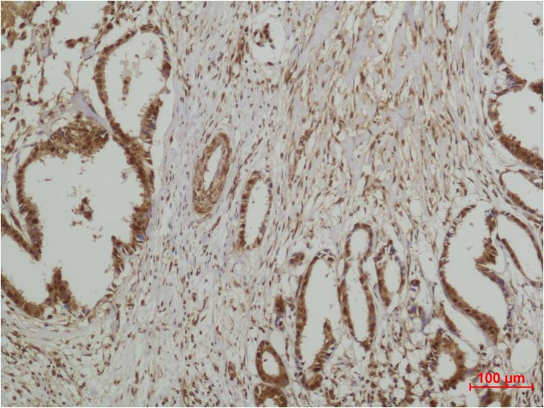 ERK5 Polyclonal Antibody (F140)