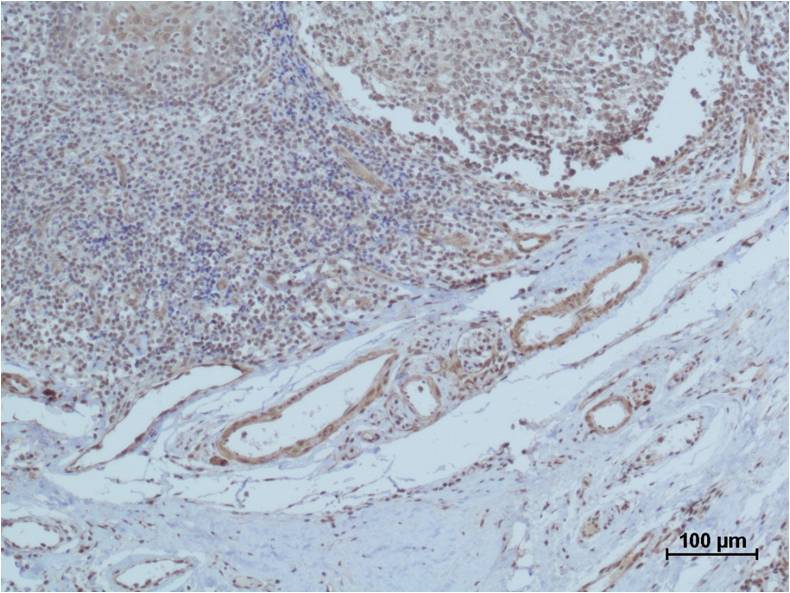 HIF-1Beta ARNT Polyclonal Antibody (F143)
