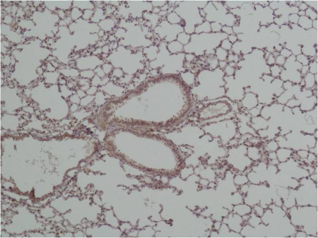 GSK 3Beta Polyclonal Antibody (F41、F43)