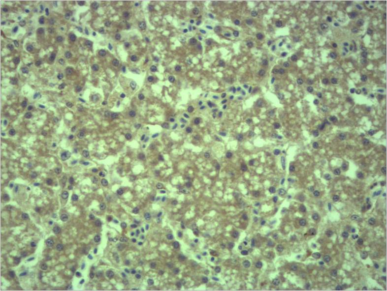 EPG5 Polyclonal Antibody (21-120)
