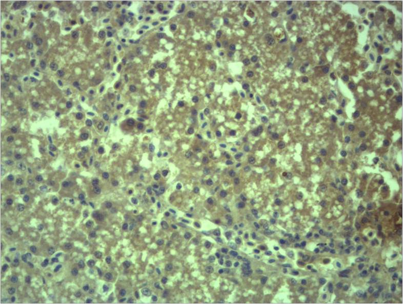 EPG5 Polyclonal Antibody (121-240)