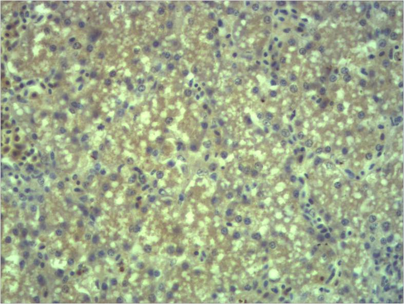 EPG5 Polyclonal Antibody (241-331)
