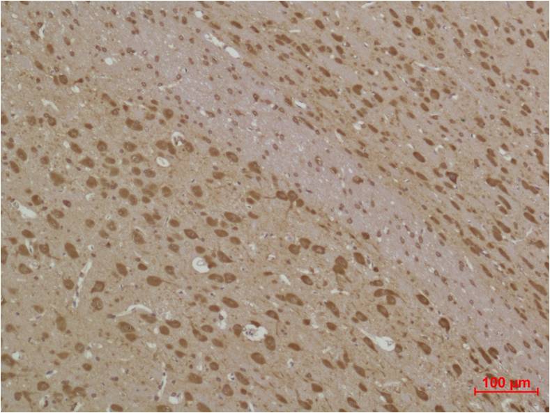 LC3B Polyclonal Antibody (F186)