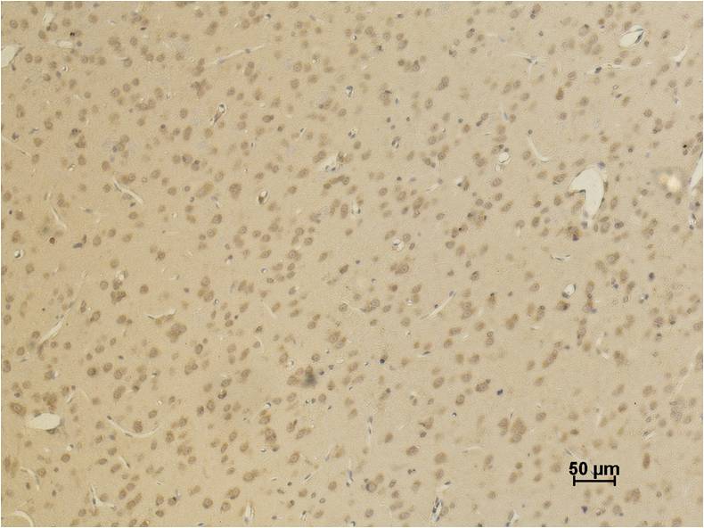 AMPA Receptor (GluR4) Polyclonal Antibody (A177)