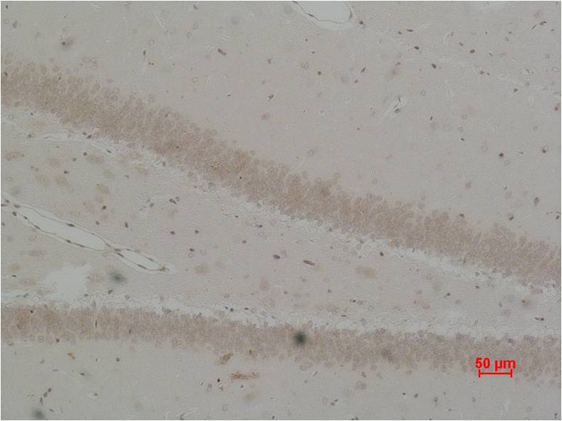 Bestrophin-2 Polyclonal Antibody (A185)