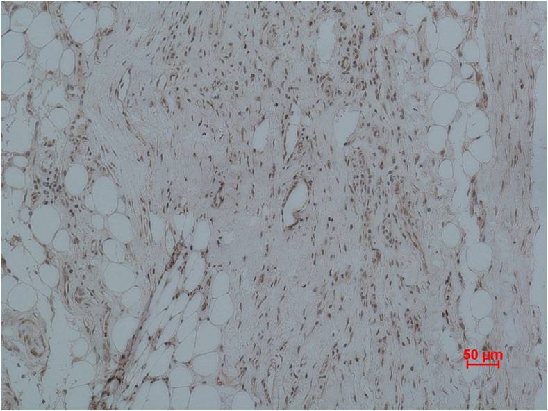 CALHM1 Polyclonal Antibody (A191)