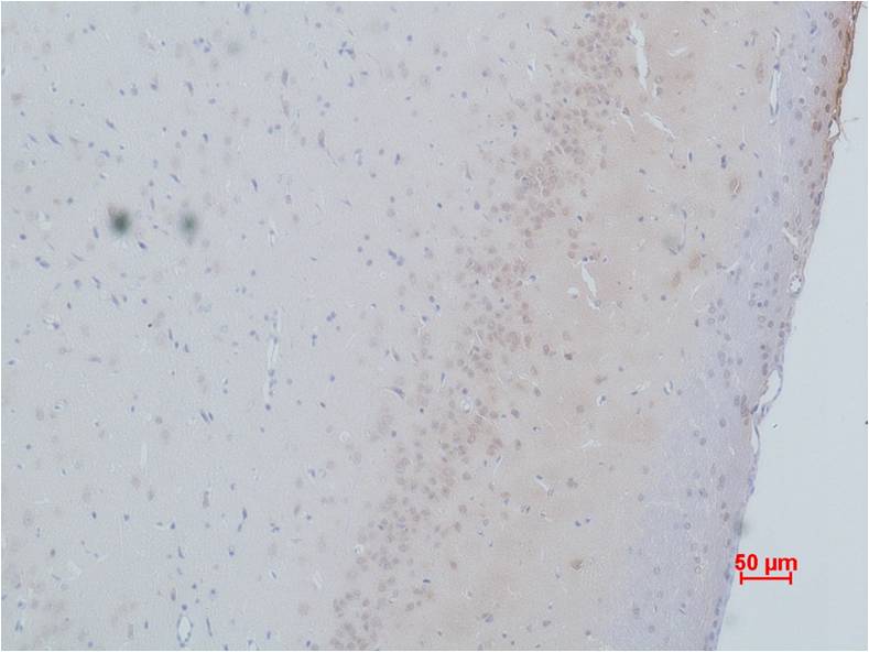 Cav Gamma2 Polyclonal Antibody (A196)
