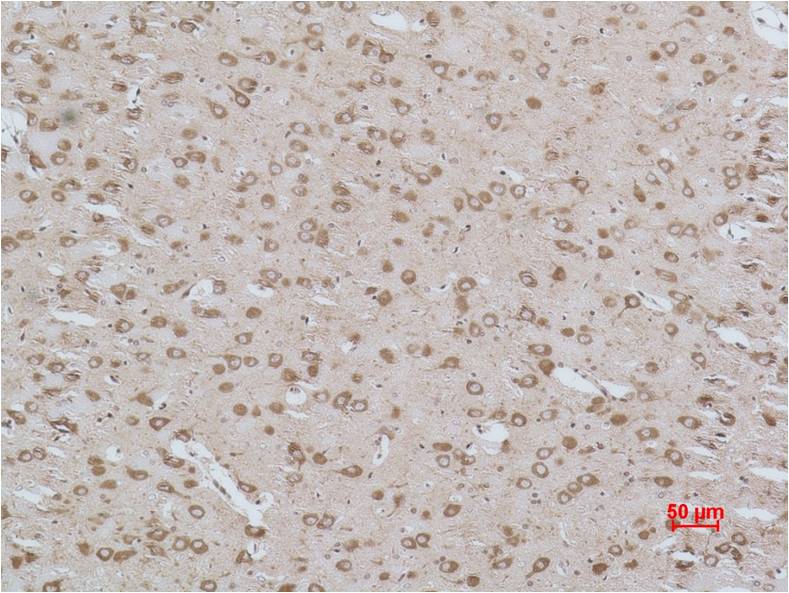 Cav Gamma3 Polyclonal Antibody (A197)