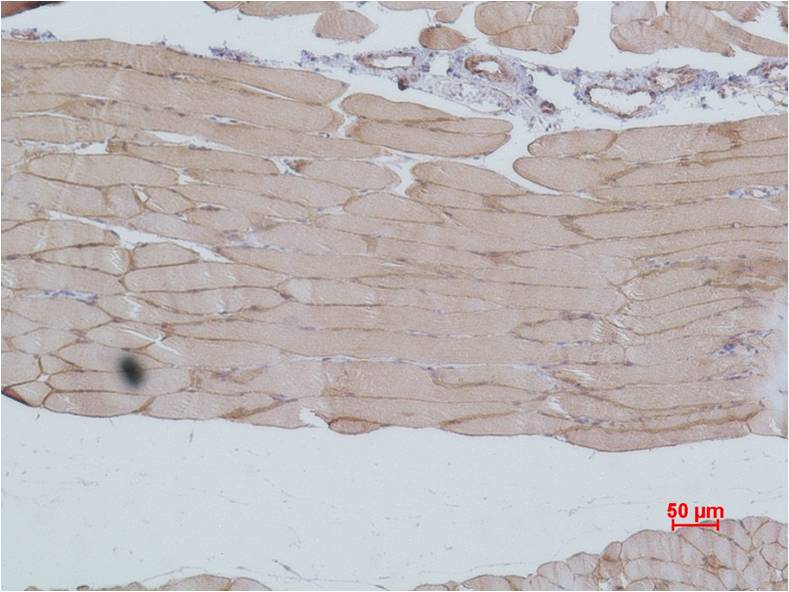 eEF1A2 Binding Protein Polyclonal Antibody (1)