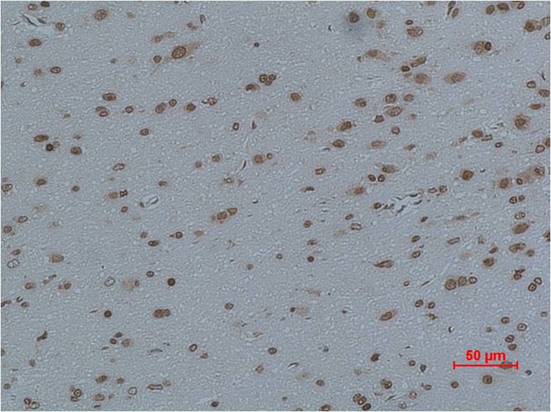 Cav Gamma4 Polyclonal Antibody (A198)