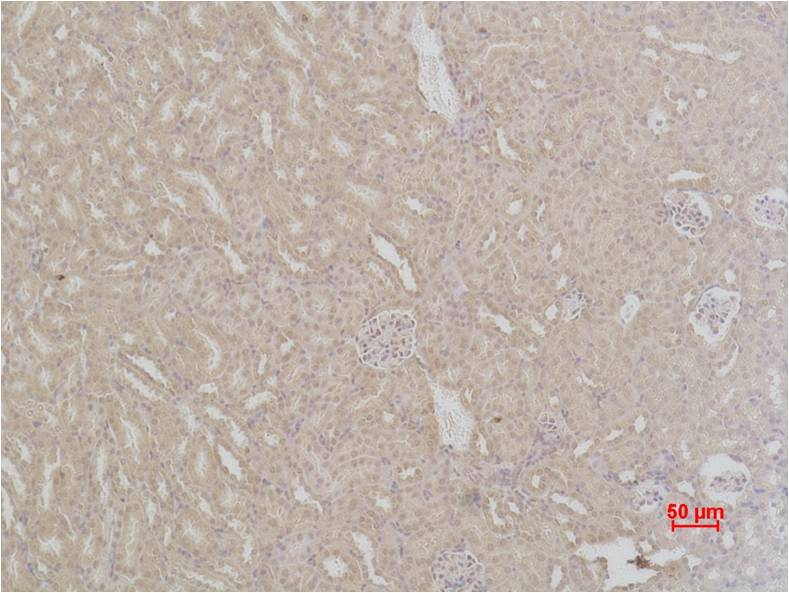SOD2 Polyclonal Antibody (F238)