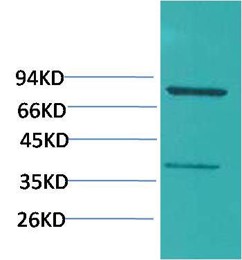 PI3 Kinase P85Alpha Polyclonal Antibody (F218)