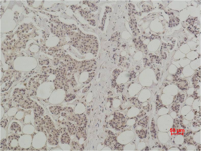 Histone H3 (Citruline R26) Polyclonal Antibody (A282)