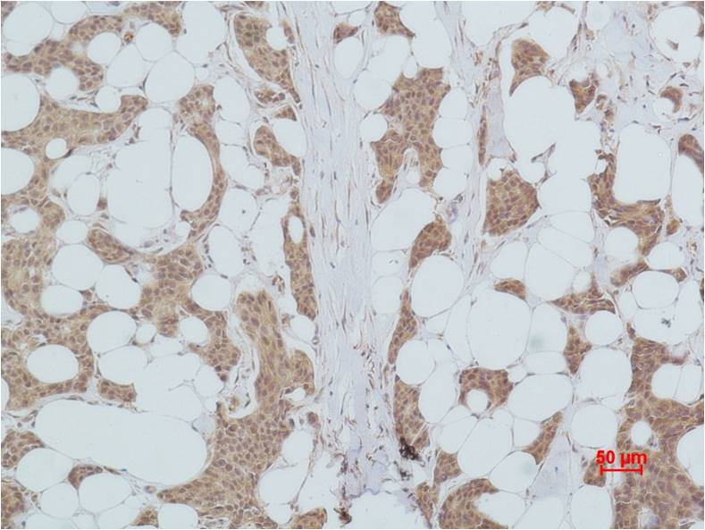 PI3 Kinase P85Alpha Polyclonal Antibody (F219)