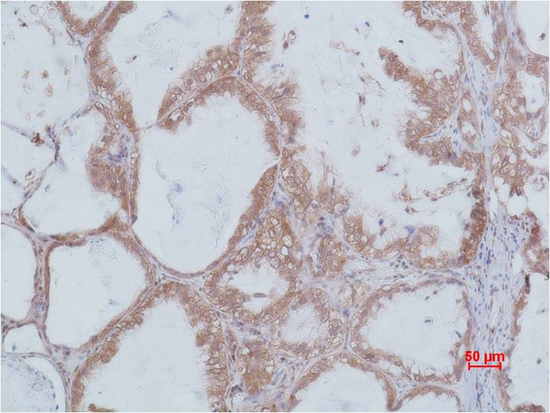 STAT2 Polyclonal Antibody (F242)