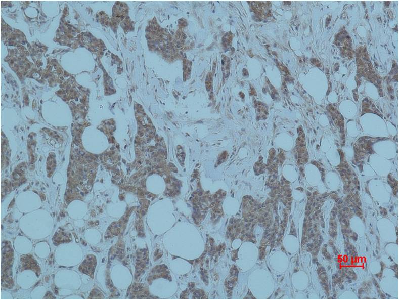 Smad3 Polyclonal Antibody (F234)
