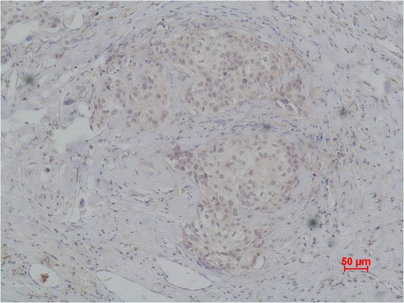 PI3 Kinase P85Beta Polyclonal Antibody (F221)