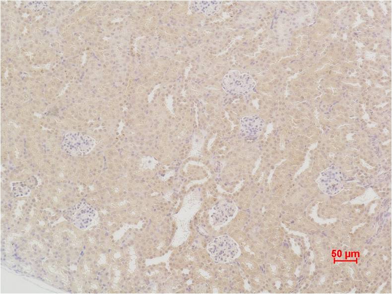 SOD2 Polyclonal Antibody (F239)