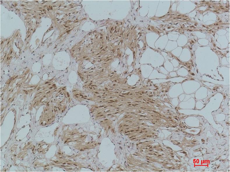 IkB Alpha Polyclonal Antibody (F169)