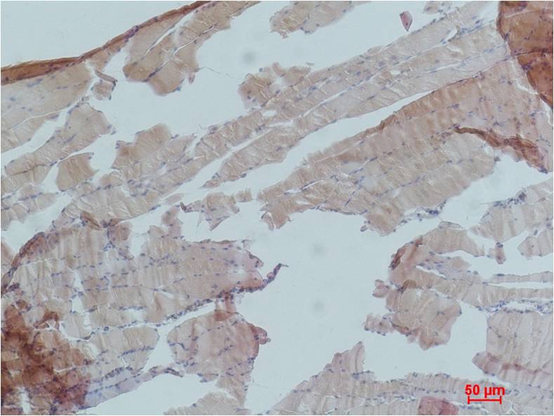 AMPKAlpha1 Polyclonal Antibody (F106)
