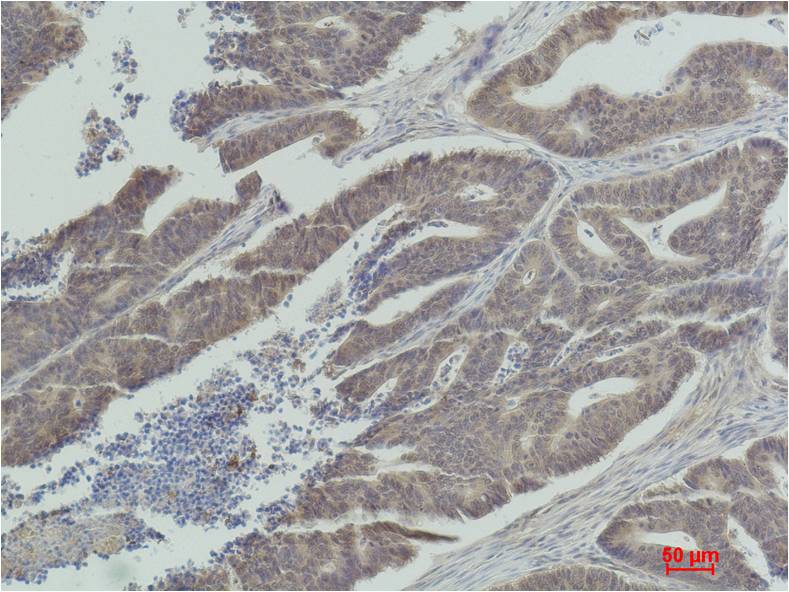 MEK1 Polyclonal Antibody (F187)