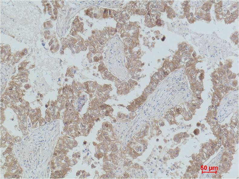 MEK2 Polyclonal Antibody (F189)