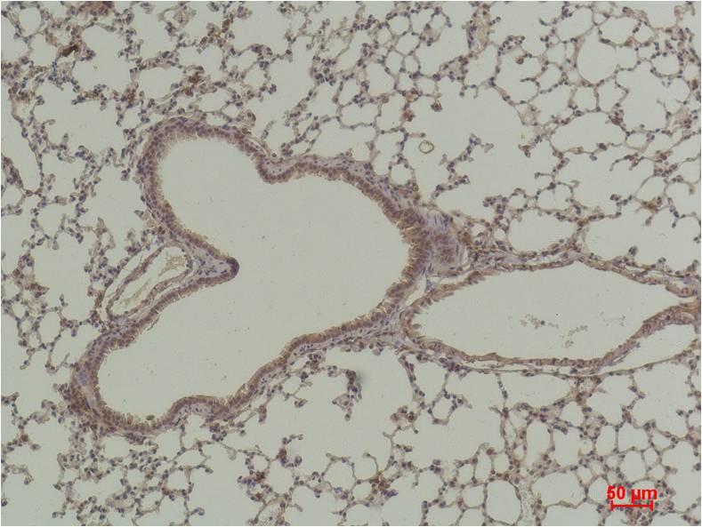 HAO1 GOX Polyclonal Antibody (GOX)