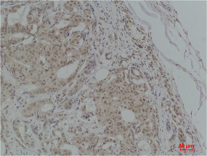 TGFBeta1 Polyclonal Antibody (F259)
