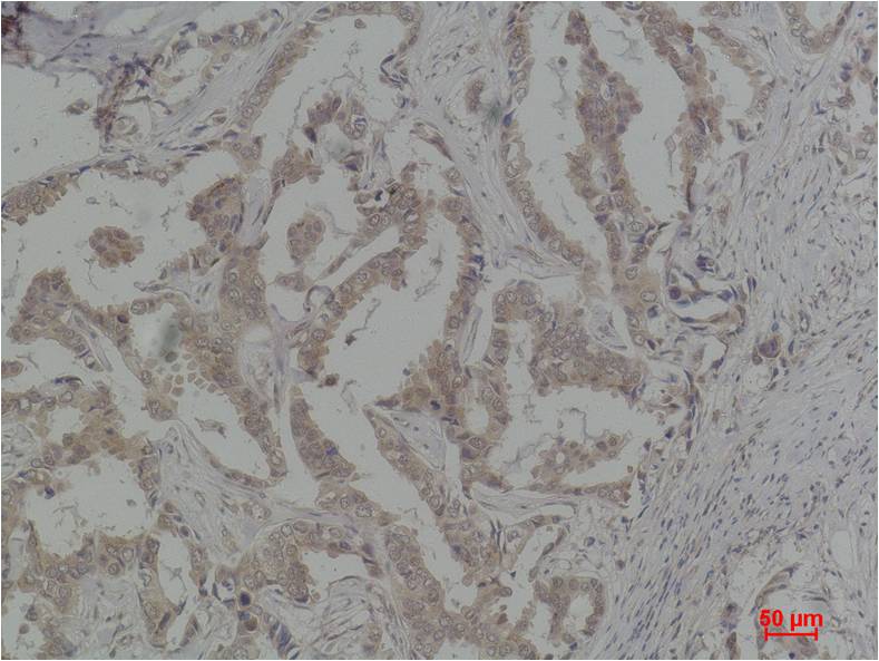 Caspase 8 Polyclonal Antibody (MTDY2)